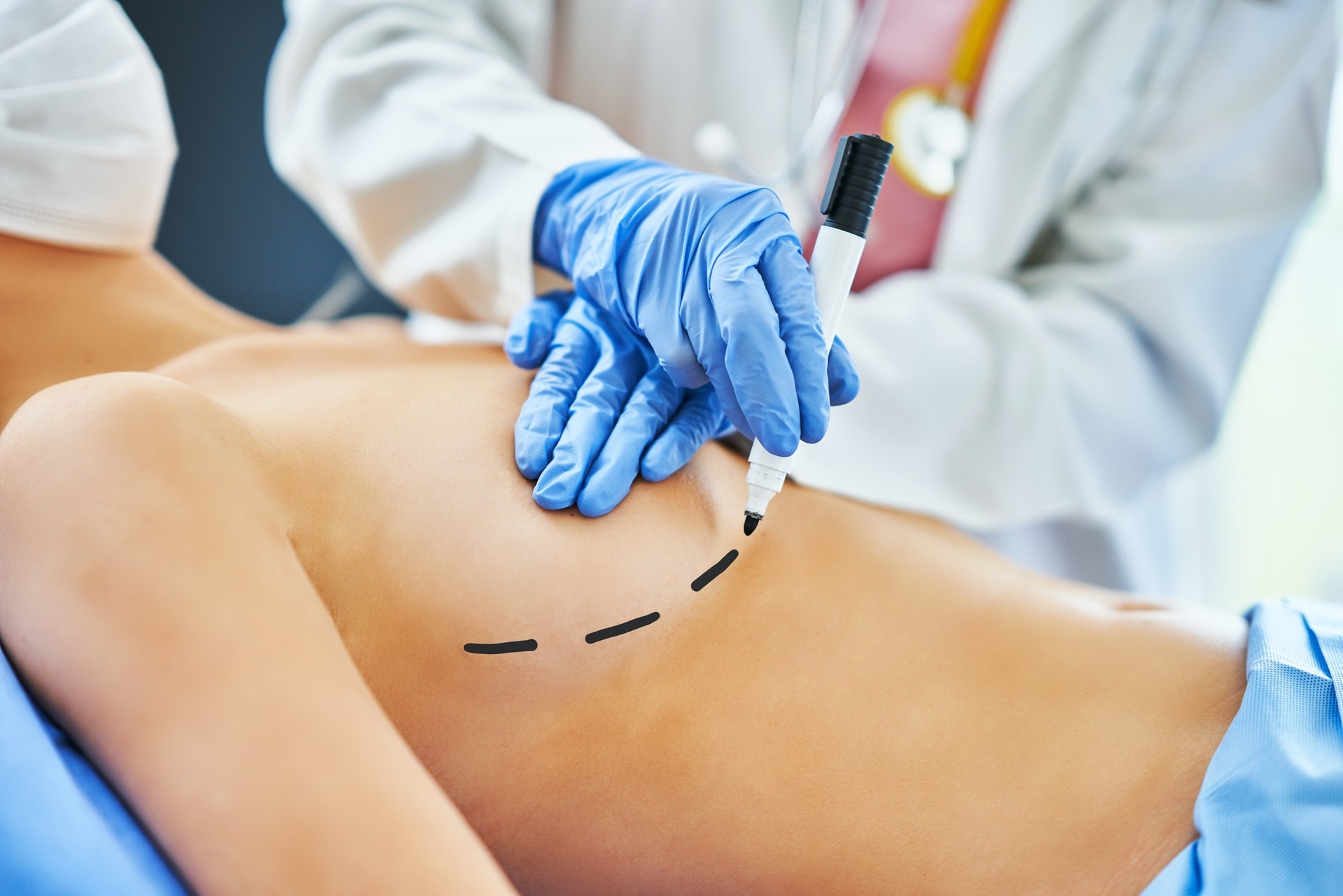 Individuelle Lösungen für Tubuläre Brust: Bochums Experten für plastische Chirurgie